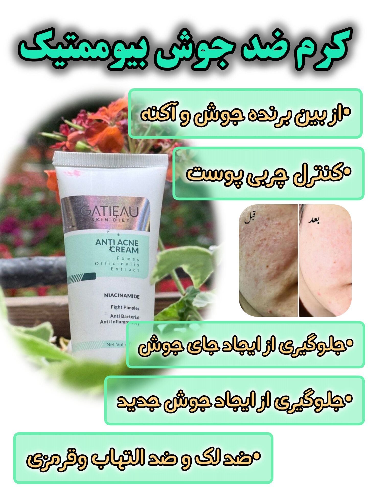 قویترین کرم ضد جوش و لک برند گاتیو ایتالیا 40 میل حجم